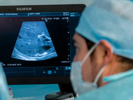 RCAD FUJIFILM-Healthcare-Europe