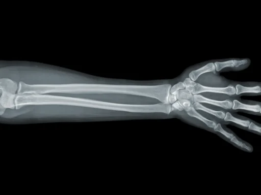 arm x-ray
