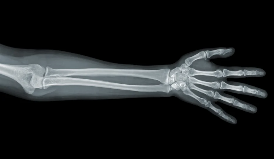 arm x-ray